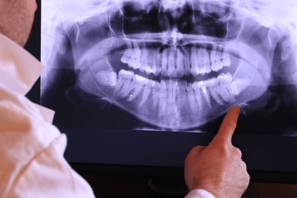 Best Broken Tooth Emergency  in Santa Cruz, CA